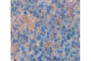 IHC-P analysis of Human Tissue, with DAB staining. (QPCT anticorps  (AA 29-361))