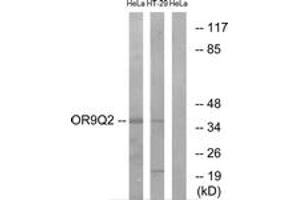 Western Blotting (WB) image for anti-Olfactory Receptor, Family 9, Subfamily Q, Member 2 (OR9Q2) (AA 232-281) antibody (ABIN2891065) (OR9Q2 anticorps  (AA 232-281))