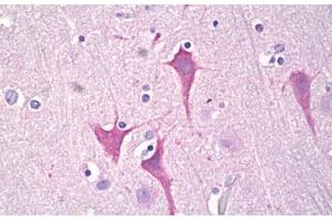 Anti-PKC Mu antibody IHC staining of human brain, cortex neurons. (PKC mu anticorps  (AA 171-220))