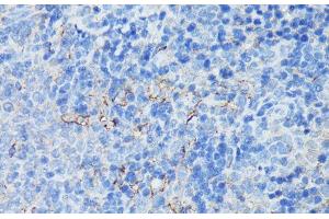 Immunohistochemistry of paraffin-embedded Rat spleen using CR2 Polyclonal Antibody at dilution of 1:100 (40x lens). (CD21 anticorps)
