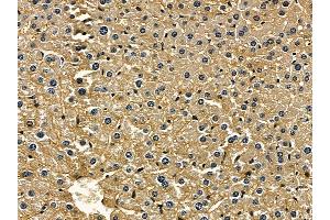 ABIN6257838 and ABIN6275608 at 1/100 staining mouse liver tissue by IHC-P. (SFRS7 anticorps  (Internal Region))