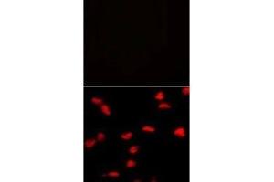 Immunofluorescence analysis of SET07 antibody and HeLa cells with (bottom) and without (top) PE-conjugated goat anti-mouse lgG secondary.
