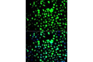 Immunofluorescence analysis of A549 cells using ZBTB25 antibody (ABIN5975302). (ZBTB25 anticorps)