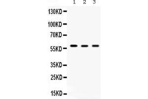 Western blot analysis of TCP1 delta using anti- TCP1 delta antibody . (CCT4 anticorps  (AA 452-539))