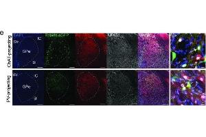 Cell-type identity of GPe projections to striatal ChAT and PV interneurons.