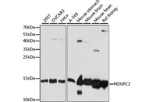 Western blot analysis of extracts of various cell lines, using NDUFC2 antibody (ABIN7268818) at 1:1000 dilution.