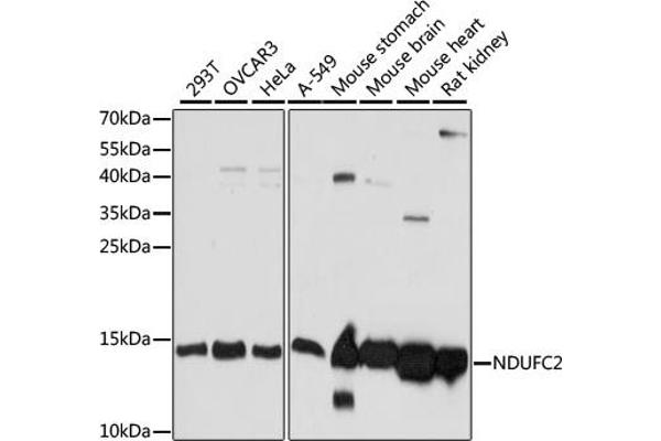 NDUFC2 anticorps  (AA 1-100)