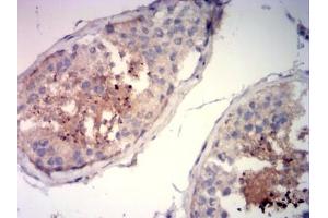 Immunohistochemical analysis of paraffin-embedded testi tissue using SP10 mouse mAb with DAB staining.