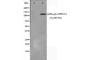 Western blot analysis on HepG2 cell lysate using Phospho-EPHA2/3(Tyr588/596) Antibody,The lane on the left is treated with the antigen-specific peptide. (EPHA2/3/4 anticorps  (pTyr588, pTyr596))
