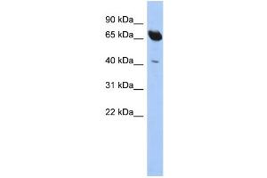 WB Suggested Anti-SCFD1 Antibody Titration: 0. (SCFD1 anticorps  (N-Term))