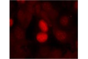 Image no. 2 for anti-Forkhead Box O1 (FOXO1) (pSer256) antibody (ABIN196812) (FOXO1 anticorps  (pSer256))