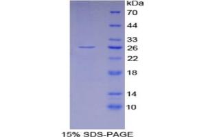 SDS-PAGE analysis of Mouse GSTa4 Protein. (GSTA4 Protéine)