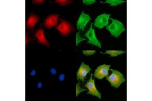 ABIN6265141 and ABIN6279832 staining  cells by IF/ICC.