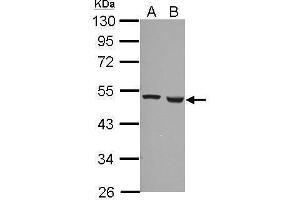 WB Image Sample (30 ug of whole cell lysate) A: A549 B: HCT116 10% SDS PAGE antibody diluted at 1:1000 (Ferredoxin Reductase anticorps)