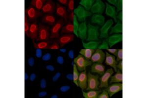 Phospho-EEF1A2 (Ser358) Antibody staining Hela cells(45 min of heat-shock treatment) by IF/ICC. (EEF1A2 anticorps  (pSer358))