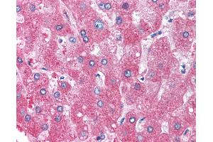 Anti-Alpha-1-Antitrypsin antibody IHC of human liver.