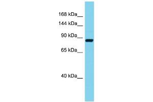 Host: Rabbit Target Name: Stim2 Sample Type: Mouse Pancreas lysates Antibody Dilution: 1. (Stim2 anticorps  (C-Term))