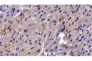 Detection of HBEGF in Human Cardiac Muscle Tissue using Polyclonal Antibody to Heparin Binding Epidermal Growth Factor Like Growth Factor (HBEGF)