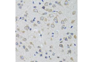 Immunohistochemistry of paraffin-embedded rat brain using HTR3A antibody (ABIN1876848) at dilution of 1:100 (40x lens). (Serotonin Receptor 3A anticorps)