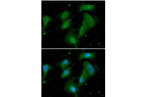 ICC/IF analysis of AKT1/3 in A549 cells.