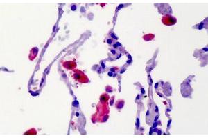 Human Lung: Formalin-Fixed, Paraffin-Embedded (FFPE)