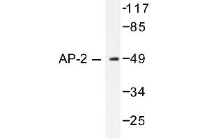 Image no. 1 for anti-Transcription Factor AP-2 alpha (Activating Enhancer Binding Protein 2 Alpha) (TFAP2A) antibody (ABIN265311) (TFAP2A anticorps)