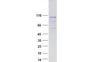 Validation with Western Blot