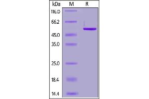 SARS-CoV-2 Nucleocapsid protein, His Tag on  under reducing (R) condition.