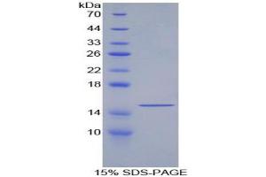 SDS-PAGE analysis of Human GDF6 Protein. (GDF6 Protéine)