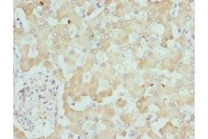 Immunohistochemistry of paraffin-embedded human liver tissue using ABIN7157806 at dilution of 1:100