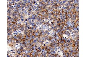 Immunohistochemistry analysis of paraffin-embedded human tonsil using CD192 Polyclonal Antibody at dilution of 1:300. (CCR2 anticorps)