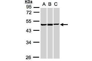 WB Image Sample(30 ug whole cell lysate) A:A431, B:HeLa S3, C:MOLT4 , 10% SDS PAGE antibody diluted at 1:1000 (BZW2 anticorps)