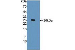 Detection of Recombinant APOB, Human using Polyclonal Antibody to Apolipoprotein B (APOB) (APOB anticorps  (AA 3365-3548))
