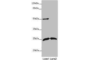 Western blot All lanes: ARHGDIG antibody at 2 μg/mL Lane 1: Mouse brain tissue Lane 2: Mouse lung tissue Secondary Goat polyclonal to rabbit IgG at 1/10000 dilution Predicted band size: 25 kDa Observed band size: 25, 50 kDa (ARHGDIG anticorps  (AA 1-225))