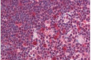 anti-SNW Domain Containing 1 (SNW1) (C-Term) antibody