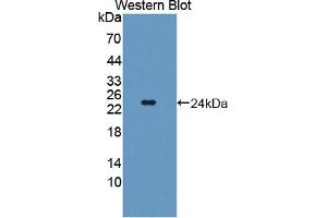 Detection of Recombinant TWSG1, Human using Polyclonal Antibody to Twisted Gastrulation Protein Homolog 1 (TWSG1) (TWSG1 anticorps  (AA 26-223))