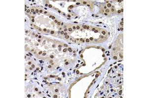 Immunohistochemistry of paraffin-embedded human kidney using H2AFY antibody at dilution of 1:100 (x400 lens). (H2AFY anticorps)
