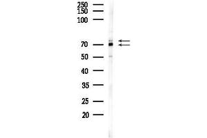 Western blot analysis of lysates from 293 cells(heat-shock 45 min treatment), using GRP78 Antibody at 1/1000 dilution.