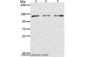 Western blot analysis of Hela, K562 and Jurkat cell, using PARP1 Polyclonal Antibody at dilution of 1:350 (PARP1 anticorps)
