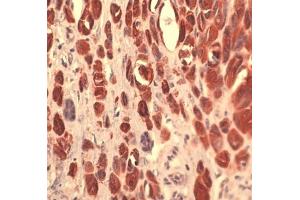 Image no. 1 for anti-S100 Calcium Binding Protein A4 (S100A4) (full length) antibody (ABIN5611426)