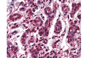 Anti-TCF3 antibody IHC of human breast. (TCF3 anticorps  (AA 522-535))