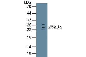 Detection of Recombinant IL1RA, Human using Monoclonal Antibody to Interleukin 1 Receptor Antagonist (IL1RA) (IL1RN anticorps  (AA 26-177))