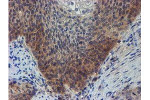 Image no. 1 for anti-Zinc Finger Protein 365 (ZNF365) (AA 108-407) antibody (ABIN1490829)