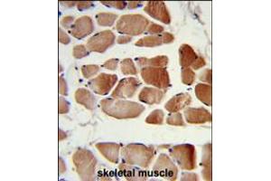 Formalin-fixed and paraffin-embedded human skeletal muscle reacted with RUVBL1 Antibody, which was peroxidase-conjugated to the secondary antibody, followed by DAB staining. (RUVBL1 anticorps)