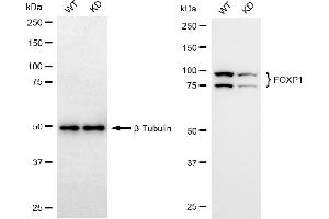 Western blotting analysis using FOXP1 antibody (ABIN7798652).