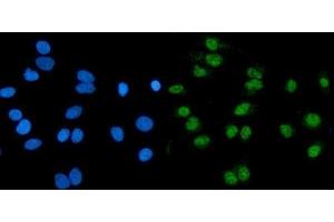 IF analysis of RNF20 using anti-RNF20 antibody (ABIN7599860). (RNF20 anticorps  (AA 123-389))