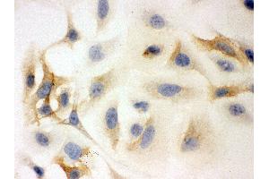 Anti- HLA-C Picoband antibody,ICC ICC: HELA Cell