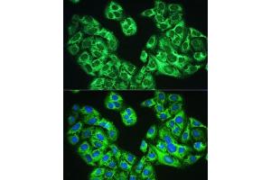 Immunofluorescence analysis of U2OS cells using YTHDF1 Rabbit pAb  at dilution of 1:100. (YTHDF1 anticorps)