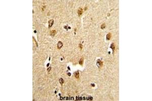 Immunohistochemistry (IHC) image for anti-Abl-Interactor 1 (ABI1) antibody (ABIN3003792) (ABI1 anticorps)