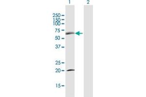 Western Blot analysis of SDPR expression in transfected 293T cell line by SDPR MaxPab polyclonal antibody. (SDPR anticorps  (AA 1-425))